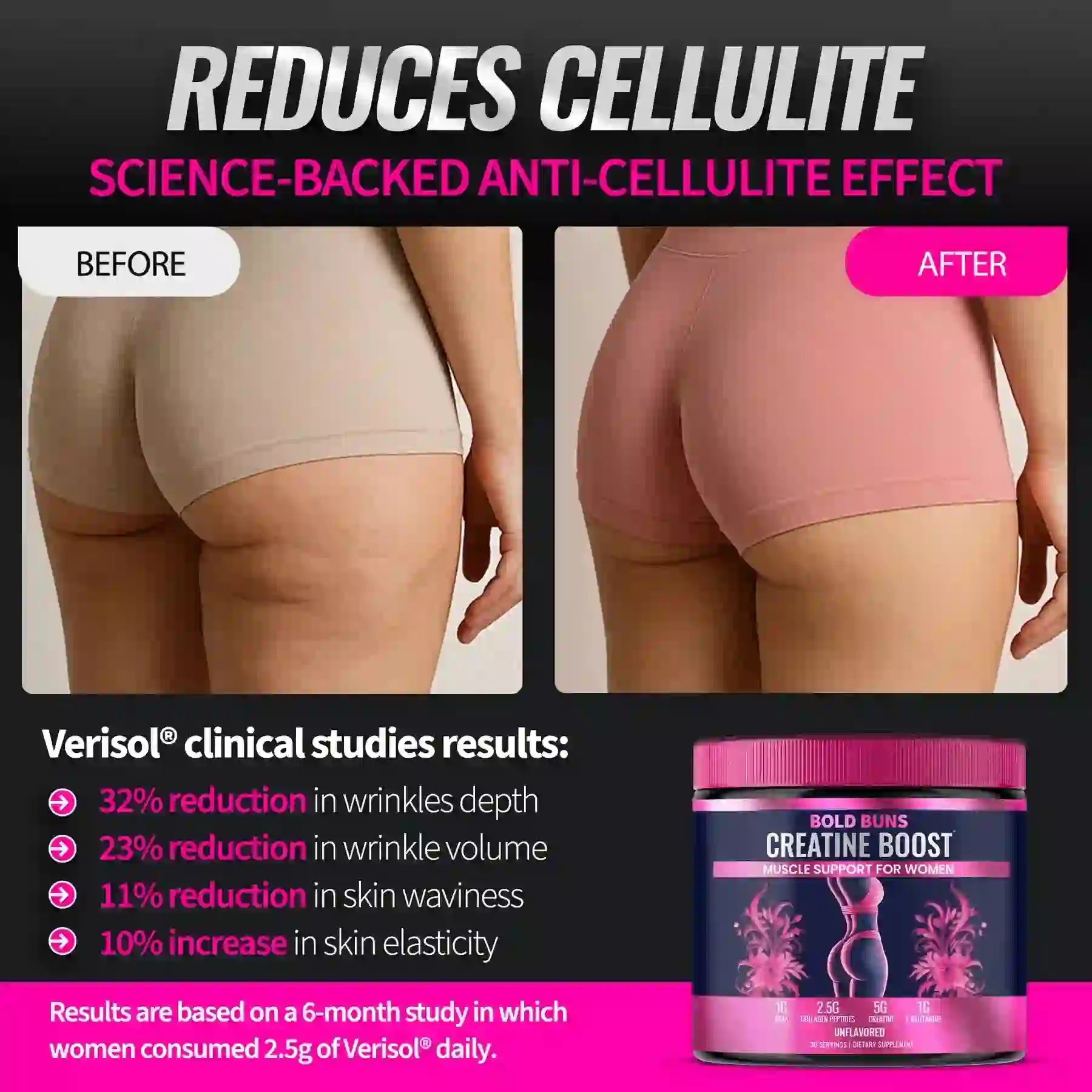 Before and after cellulite reduction using Best Selling Creatine Shape Muscle & Smooth Cellulite with Verisol® clinical study results.
